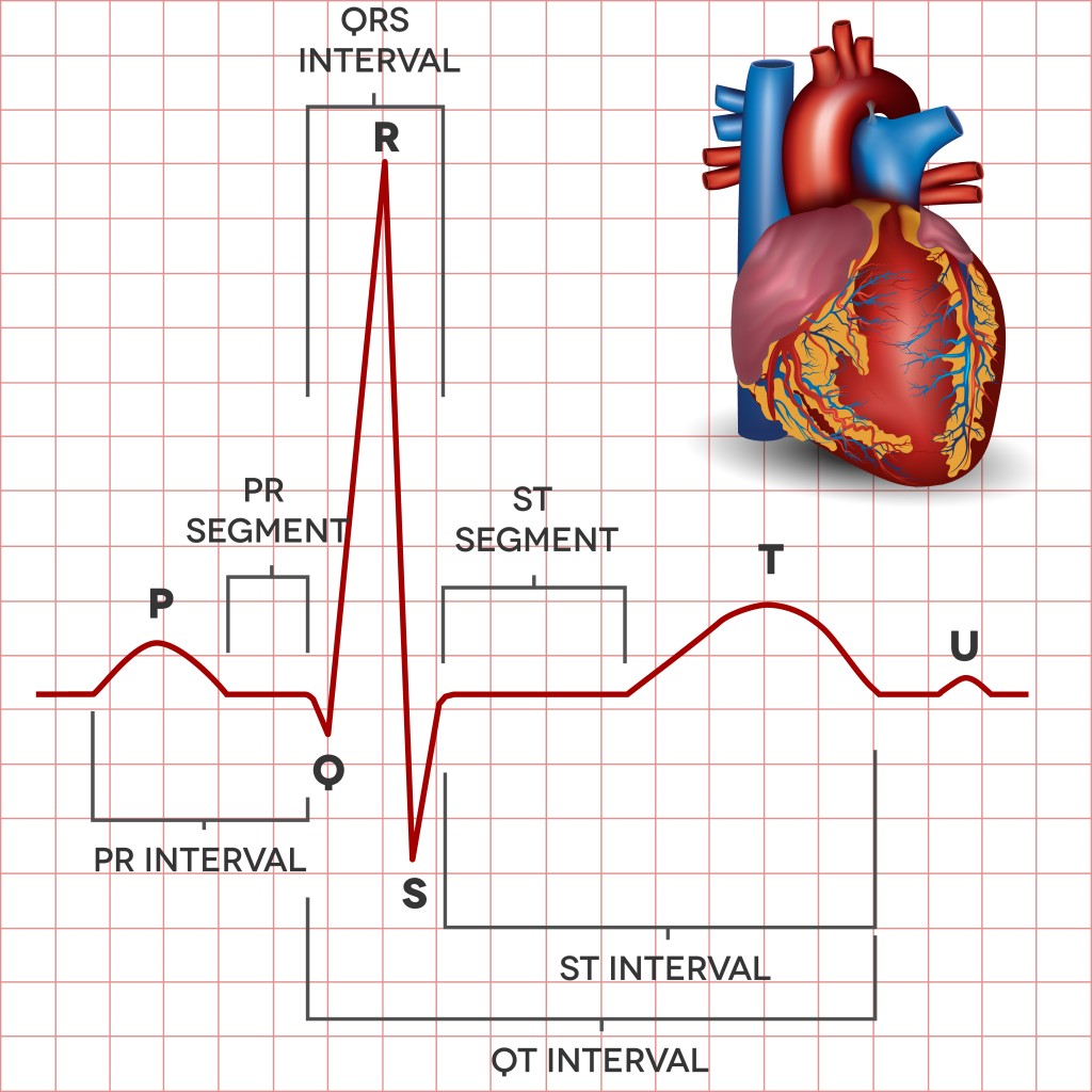 EKG Diagram Labeled