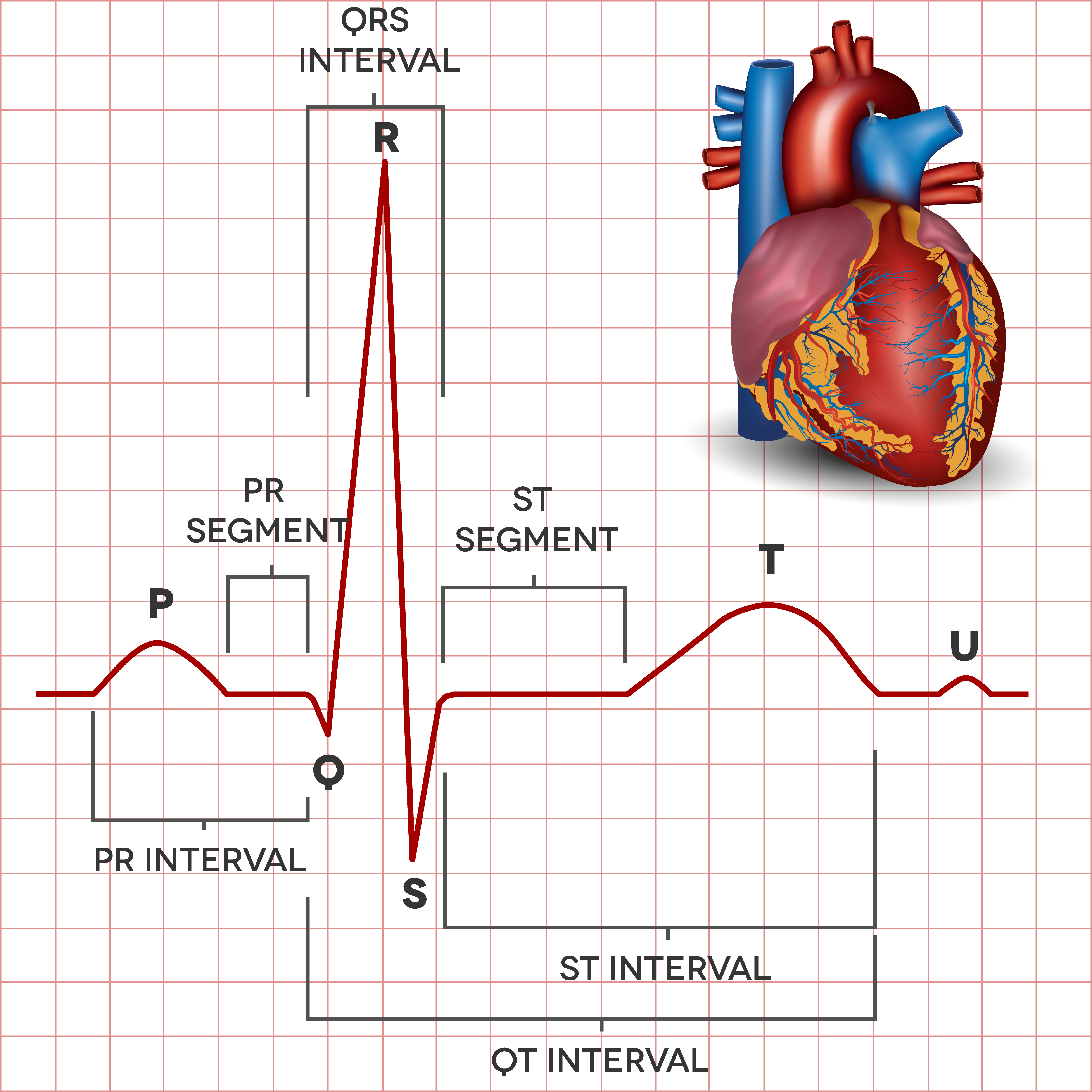 normal 12 lead ecg labeled