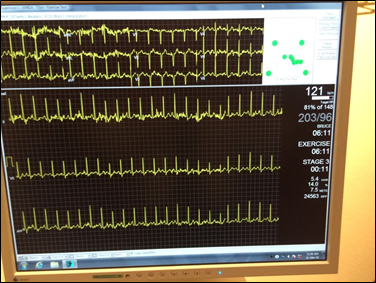 24h ECG Holter Monitor £170, London Cardiology Clinics